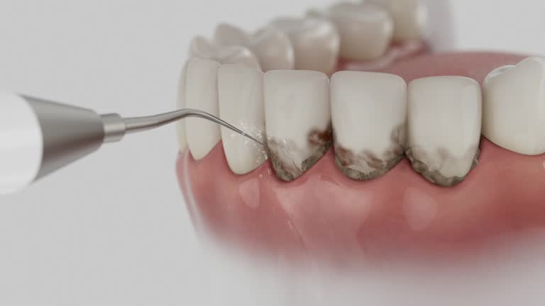 Reliable Teeth Cleaning And Checkup contractor in Carroll County County, IA by Dentist Open Now